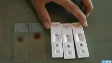 Le paludisme se propage amplement dans le sud de l’Algérie