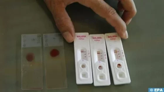 Le paludisme se propage amplement dans le sud de l’Algérie